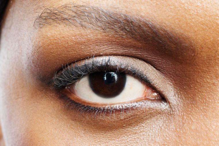 The Laser Cataract Surgey