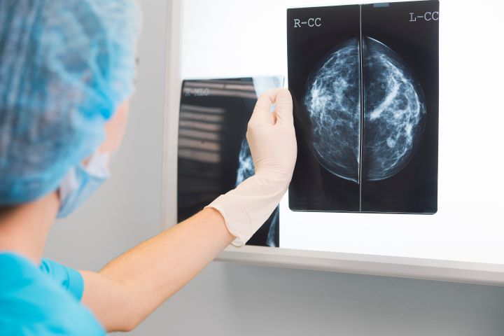 Myth: If your mammography report is negative, there is nothing to worry about.