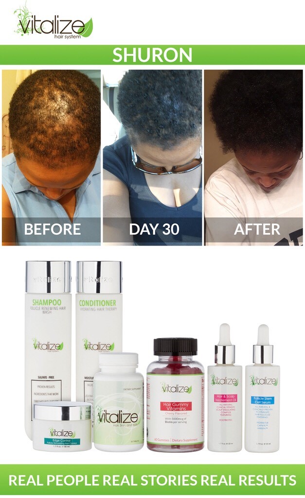 The Vitalize Hair System Will Help You Regrow Your Hair