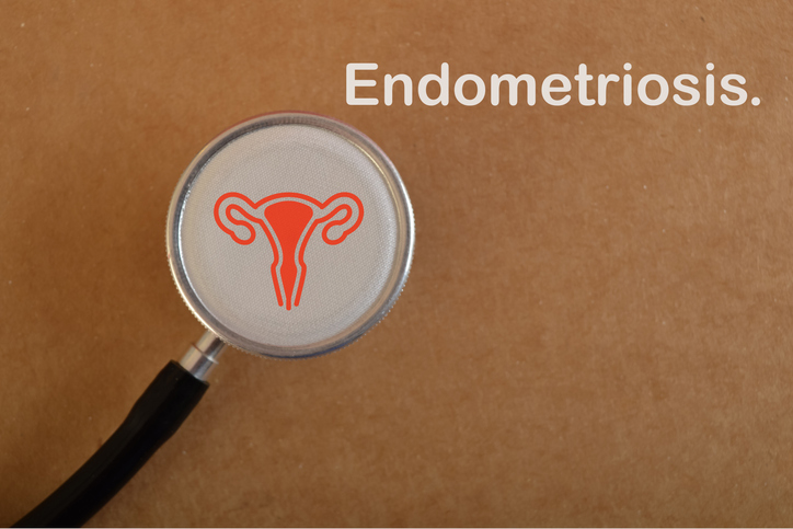 Vagina symbol on stethoscope with text ENDOMETRIOSIS.Endometriosis is a medical condition in which the tissue that normally lines the inside of the uterus (endometrium) grows outside of the uterus.