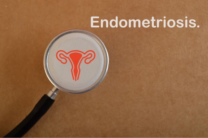 Suffering from Endometriosis? Learn About the Serene Study
