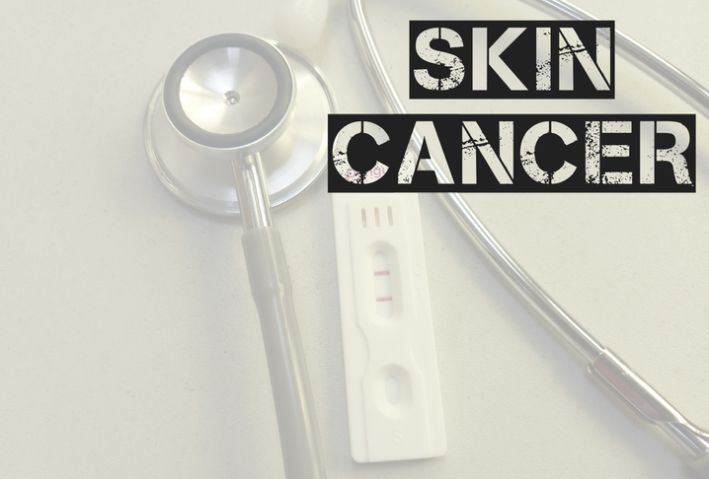 Skin Cancer Term, health concept. Medical conceptual image.