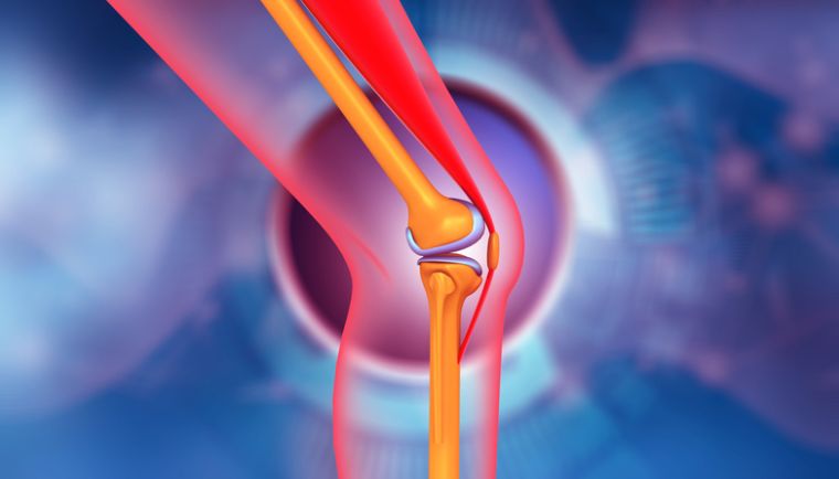 Osteoarthritis and Rheumatoid Arthritis: What’s the Difference?