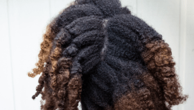 Small Doses_285 Side Effects of Textured Hair with Anthony Dickey