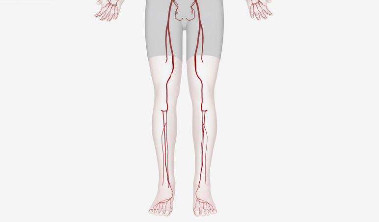 The Lower Extremity Arteries 3D