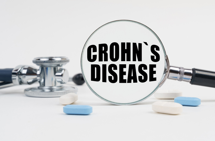 On a white surface lie pills, a stethoscope and a magnifying glass with the inscription - CROHNS DISEASE