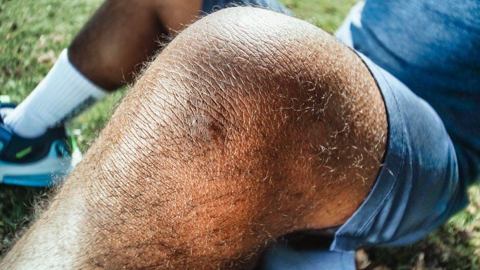 Recognizing Early Signs of Knee Arthritis in Black People Is Crucial